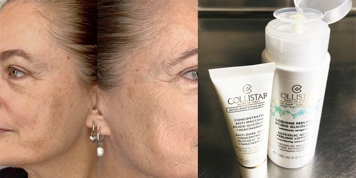 Lydia test Collistar's Glycolic Acid Peeling Lotion & Spot Concentrate